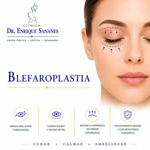 Blefaroplastía (párpados) - Clínica Dr. Enrique Sananes