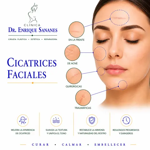Cicatrices faciales - Clínica Dr. Enrique Sananes