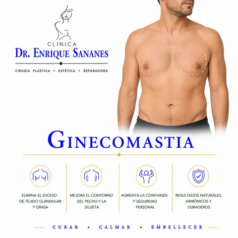 Ginecomastia - Clínica Dr. Enrique Sananes