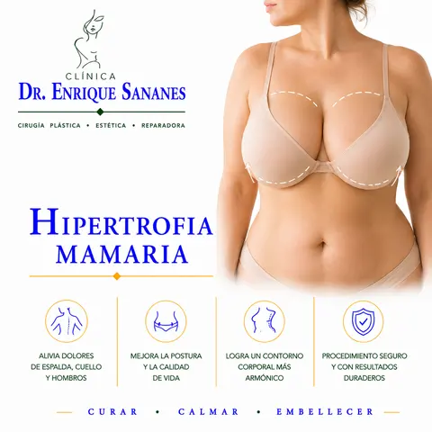 Hipertrofia mamaria - Clínica Dr. Enrique Sananes