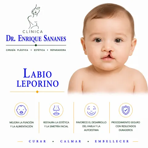 Labio leporino - Clínica Dr. Enrique Sananes