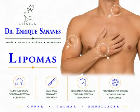 Lipomas - Clínica Dr. Enrique Sananes