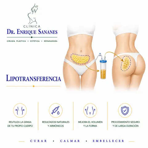 Lipotransferencia - Clínica Dr. Enrique Sananes