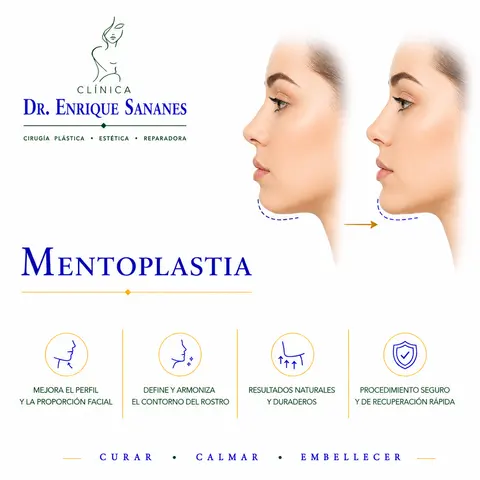 Mentoplastía - Clínica Dr. Enrique Sananes