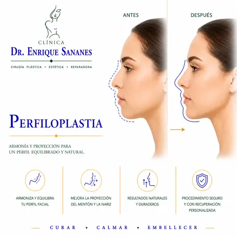 Perfiloplastía - Clínica Dr. Enrique Sananes