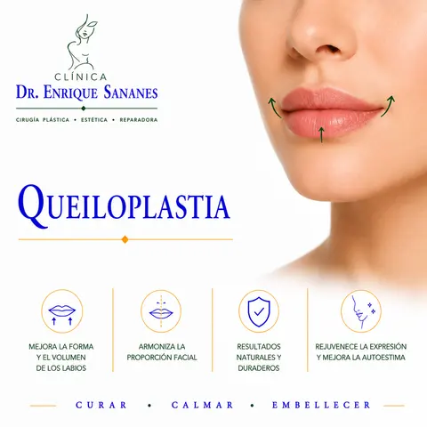 Queiloplastía - Clínica Dr. Enrique Sananes