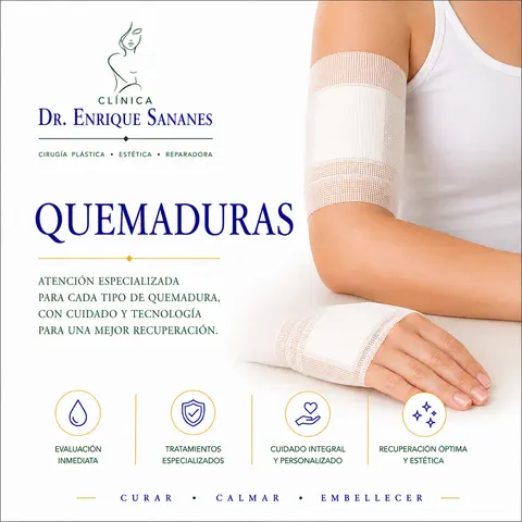 Quemaduras - Clínica Dr. Enrique Sananes