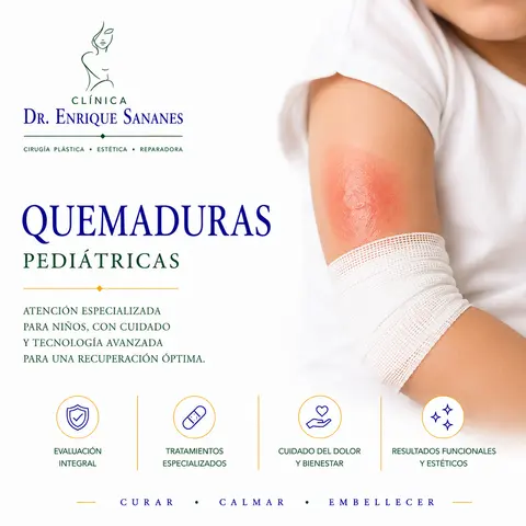 Quemaduras pediátricas - Clínica Dr. Enrique Sananes