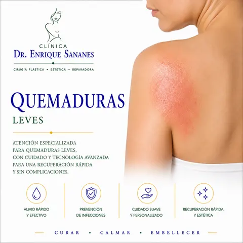 Quemaduras leves - Clínica Dr. Enrique Sananes