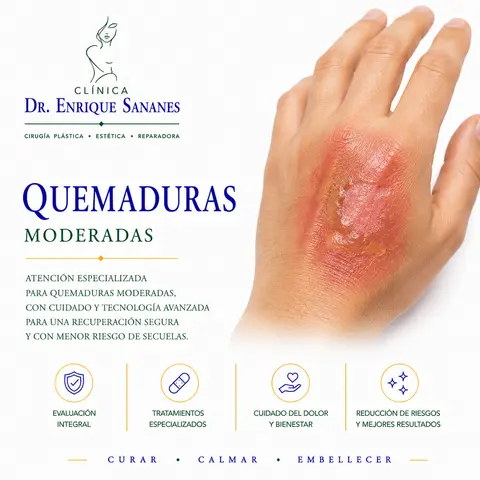 Quemaduras moderadas - Clínica Dr. Enrique Sananes