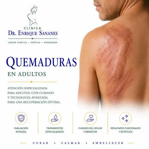 Quemaduras en adultos - Clínica Dr. Enrique Sananes
