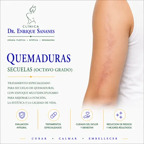 Secuelas de quemaduras - Clínica Dr. Enrique Sananes