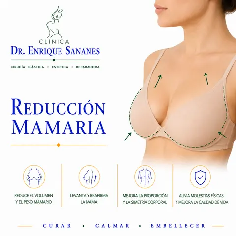 Reducción mamaria - Clínica Dr. Enrique Sananes