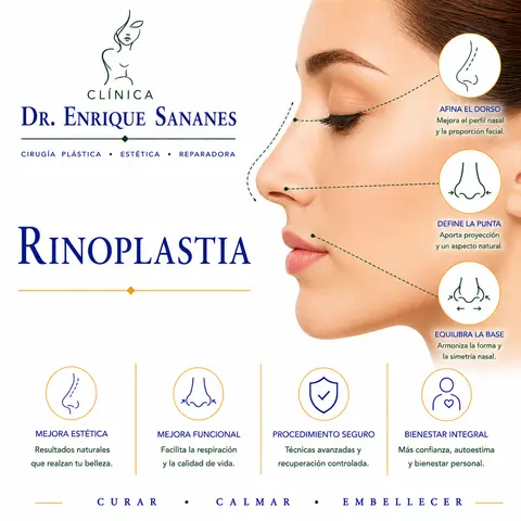 Rinoplastía (nariz) - Clínica Dr. Enrique Sananes