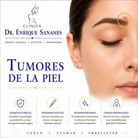 Tumores de la piel I - Clínica Dr. Enrique Sananes